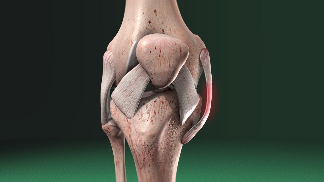 Medial Collateral Ligament Treatment In Rewa